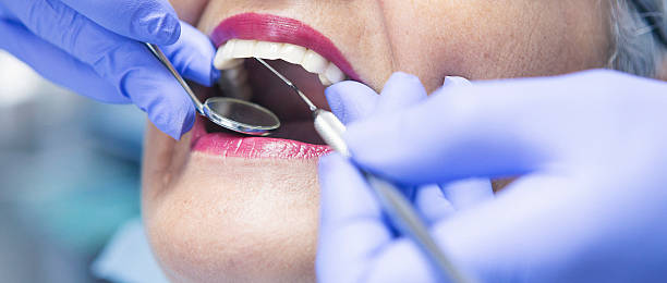 Best Emergency Root Canal Treatment in Seis Lagos, TX